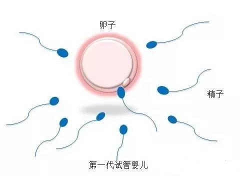 液氮存储